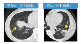 lung_02.jpg